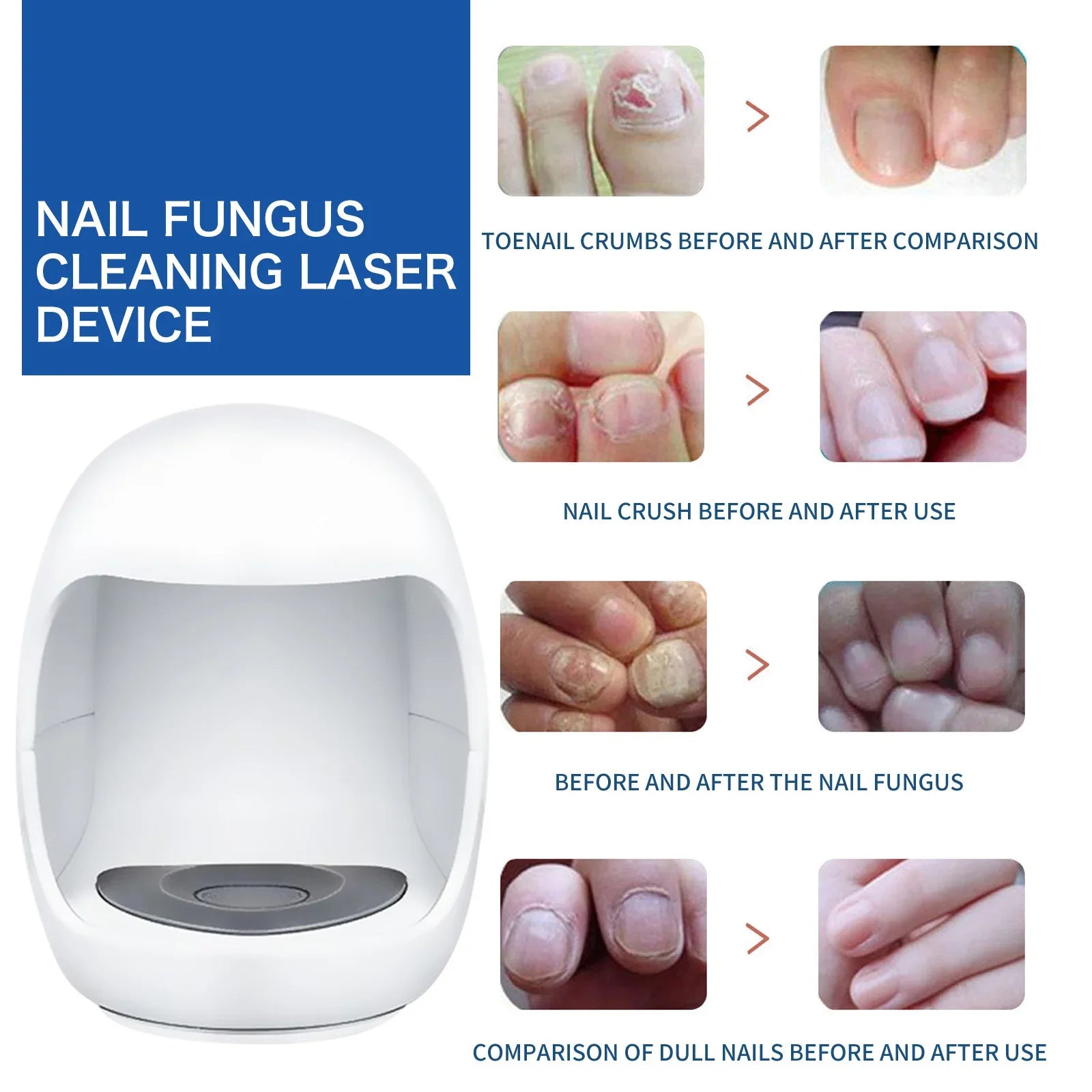 Fungal Nail Laser Device Repair Fast Nails Fungus Onychomycosis